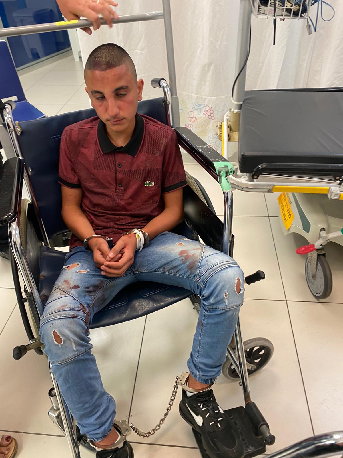 Youssef suffered a fractured nose and bruising in several parts of his body, according to a medical report seen by his lawyer [Courtesy: Janan Abdu]