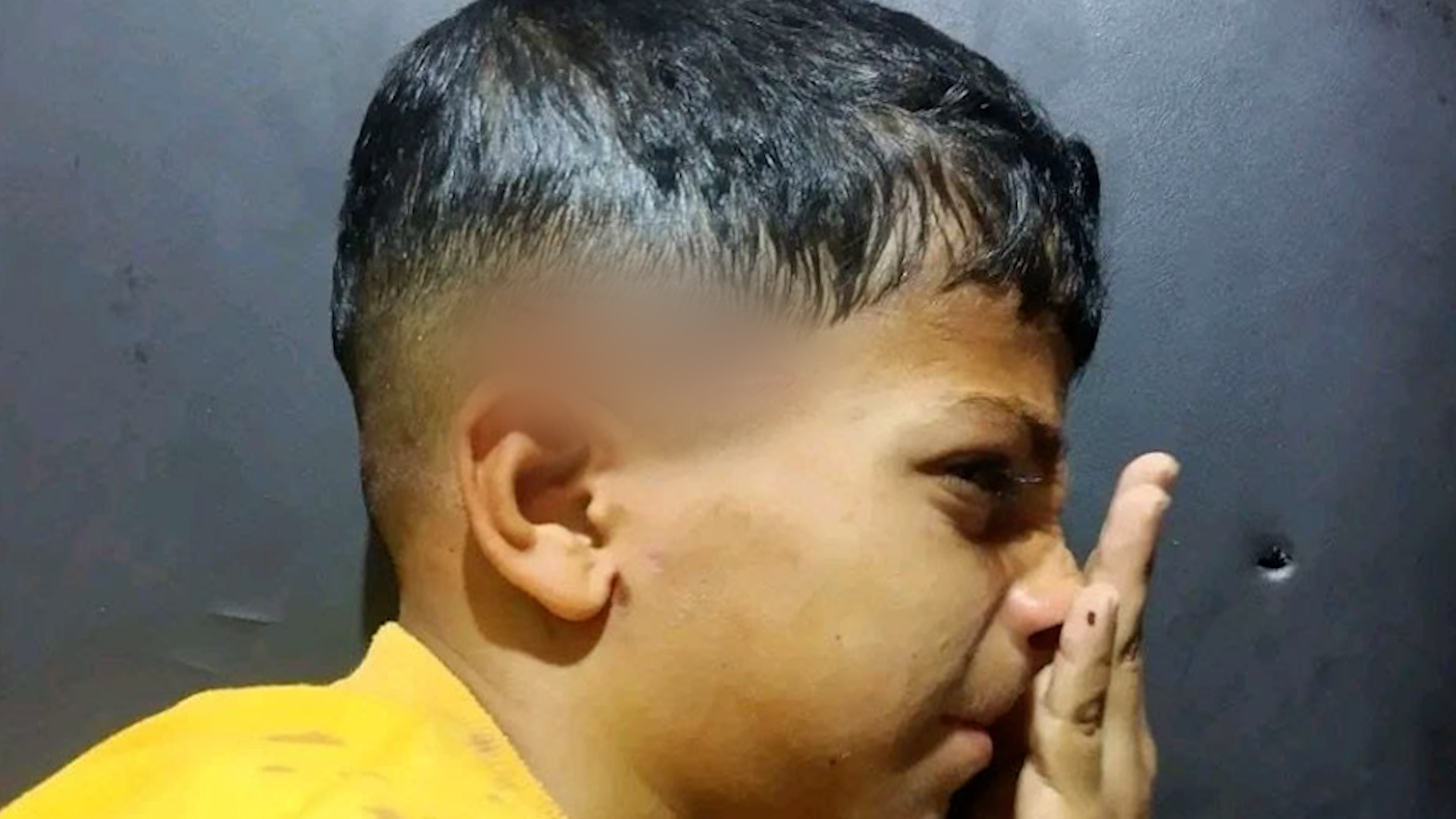 Imad Salem Zahra, the Palestinian child whose photo went viral after he was shot in the head by Israeli soldiers, tells Al Jazeera what happened that day.